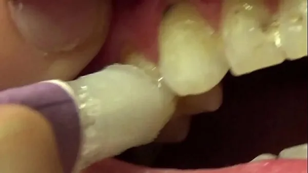 Watch Applying Whitening Paste To Her Filthy Teeth mega Tube